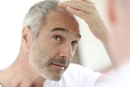 Haarverlust ist ein häufiges Problem